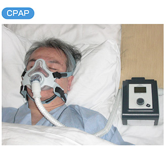 CPAP(シーパップ)治療とは