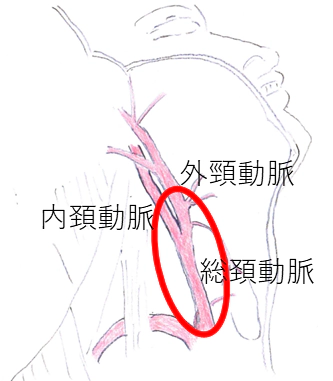 頸動脈エコー