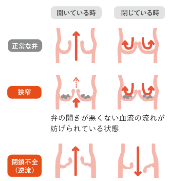 画像に alt 属性が指定されていません。ファイル名: image-1.png