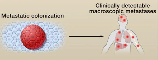 血中循環腫瘍細胞検査（CTC検査）