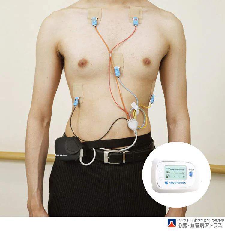 ホルター心電図