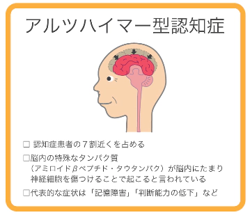 MCIスクリーニング検査